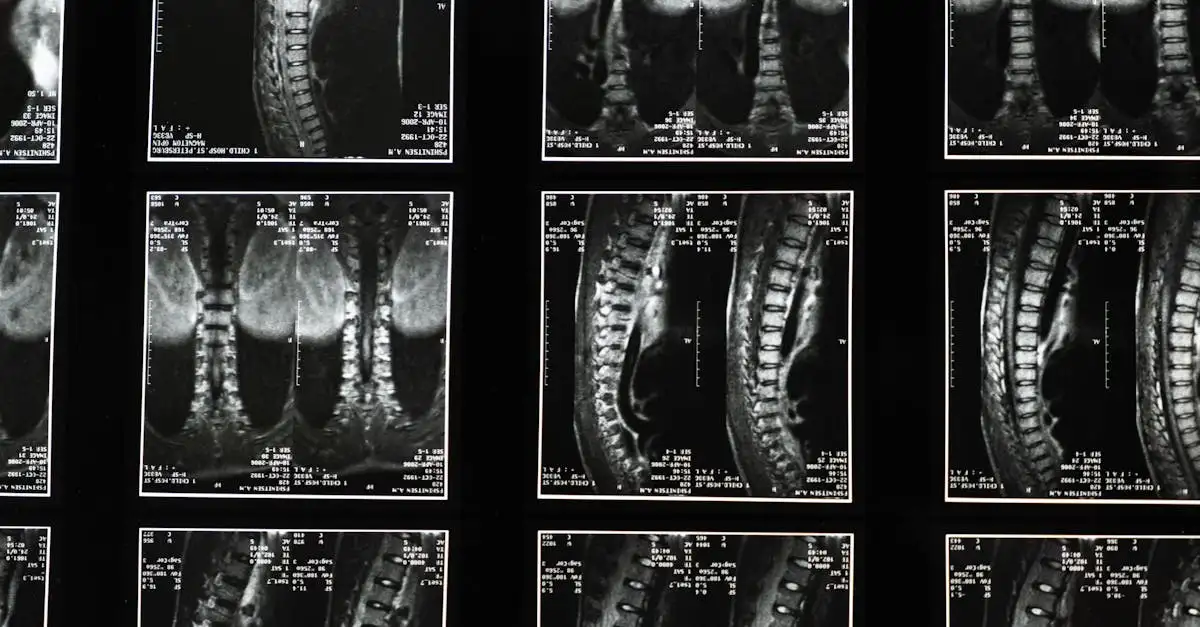 Zwangerschap ischias: Oorzaken, symptomen en verlichting